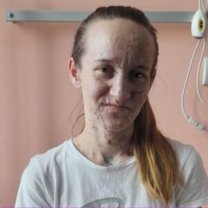“Erdhën nga ferri”, historia tra`gjike e nënës ukrainase me dy binjakët e saj, si i verboi bom`ba