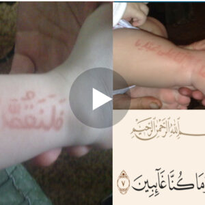 SubhanALLAH/ Në trupin e një foshnje të posalindur shkraun Sura el-araf që don të thotë…(VIDEO)