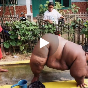 Një djalë 13-vjeçar, i cili dikur peshonte 423 Kg, ka humbur më shumë se gjysmën e peshës së tij falë nje..(VIDEO)