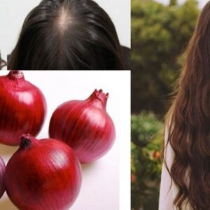 Habi: Qepa E Kuqe Ndalon Rënien E Flokëve, Mësoni Si Ta Përdorni!