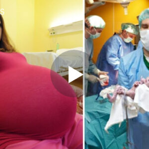 Ajo mendoi se do të kishte binjakë, por ajo pati një lindje që tronditi mjekët që ndodhte çdo 500 vjet(VIDEO)