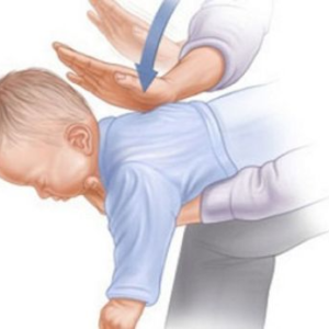 Patjetër ta mësoni / Kështu mund ta shpëtoni foshnjën kur i zihet fryma…