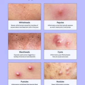 ED1ECD6D-17B1-47E8-B8A6-4D411BDC0562